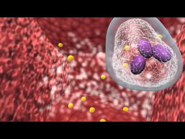 Bacterial infection and host response.