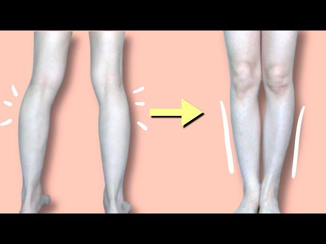 SUB)3 EXERCISE TO FIX YOUR LEG PROBLEM [KNOCKED KNEES, BACK KNEES]