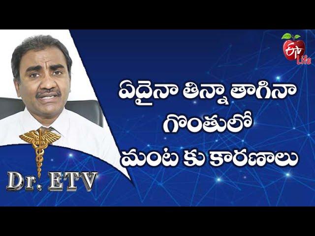 Sore Throat And Acid Reflux|ఏదైనా తిన్నా తాగినా గొంతులో మంట కు కారణాలు | Dr.ETV | 30th December 2021