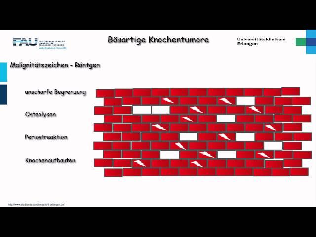 Orthopädie ─ Bösartige Knochentumore Teil 1/2