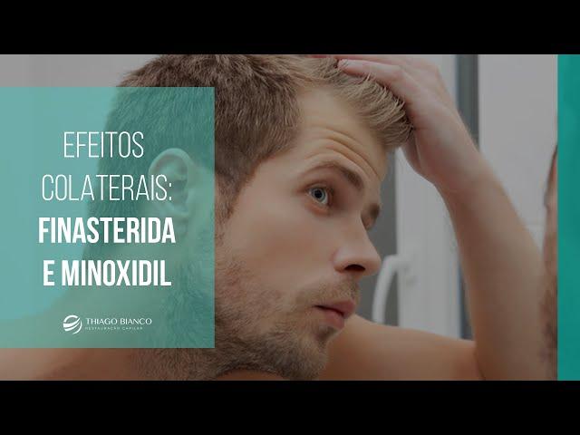 Aplicações e efeitos colaterais de Finasterida e Minoxidil