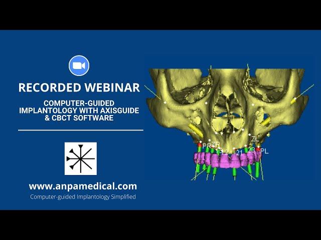 Computer-guided implantology with AxisGuide & CBCT Software.