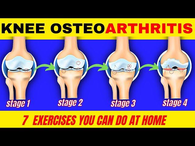 SAY GOODBYE to KNEE PAIN with These 7 SIMPLE EXERCISES for KNEE OSTEOARTHRITIS| Doc Cherry