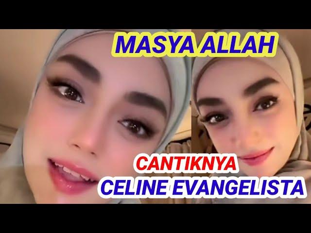 Masya Allah !! Celine Evangelista Cantik Memakai Hijab