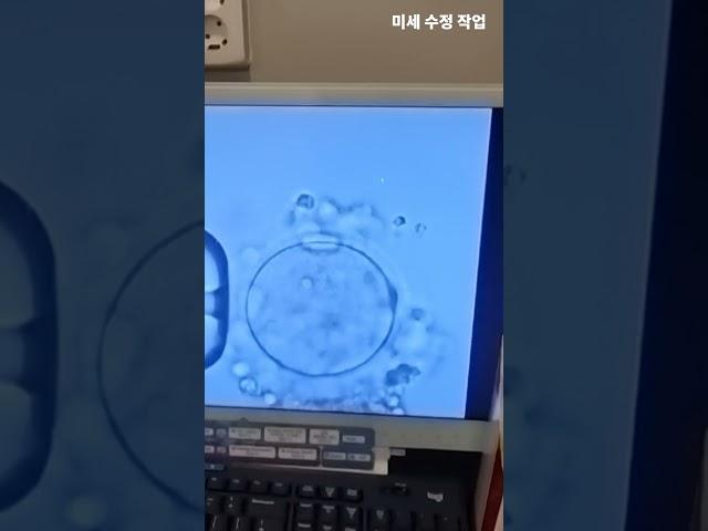 난임의학연구소 미세수정 '리오라여성의원' #난임 #시험관아기 #난임병원