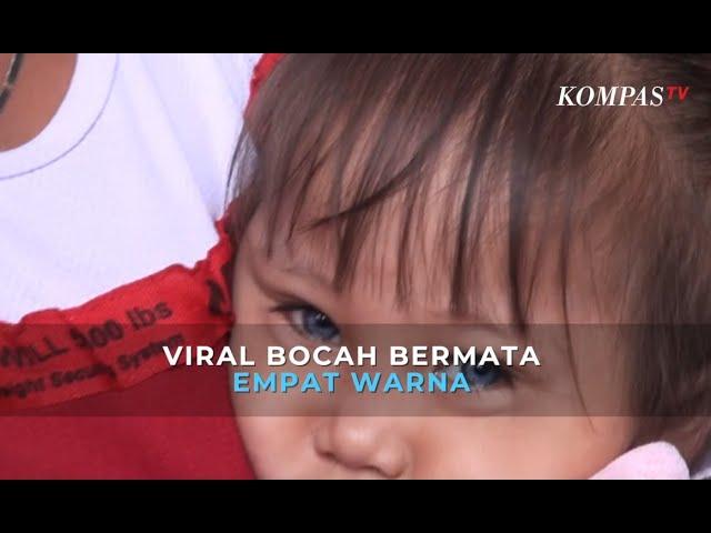 Viral! Bocah Berbola Mata Empat Warna