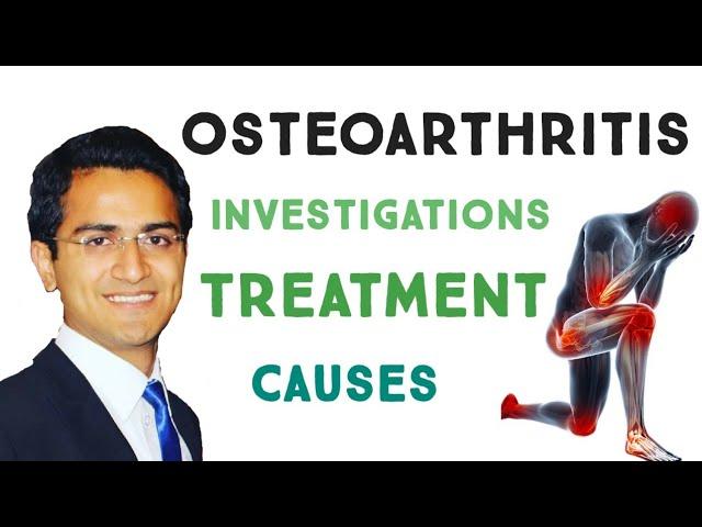 OSTEOARTHRITIS | SIGNS & SYMPTOMS | X RAY FINDINGS | OSTEOARTHRITIS TREATMENT | RISK FACTORS |