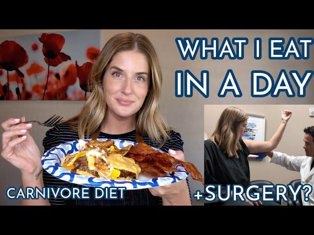 What I Eat + Surgery Consultation