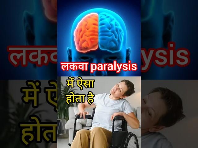 stroke paralysis