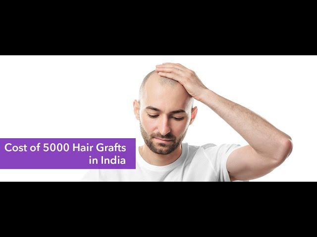 5000 Grafts Hair Transplant in India | 5000 Grafts Hair Transplant Cost in India