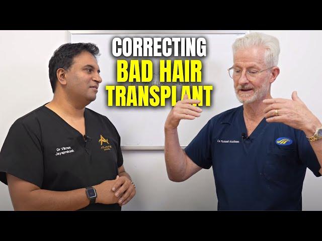 Correcting Poor Hair Transplant Surgery