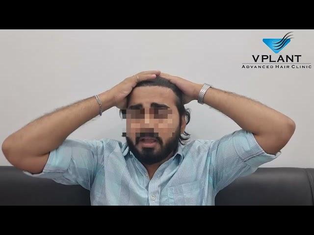 A Happy Client | Testimonial | Vplant Hair Transplant Clinic