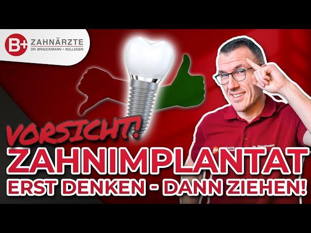 Lass dir KEINE IMPLANTATE setzen (bevor du dieses Video gesehen hast): Zahnarzt REALTALK!