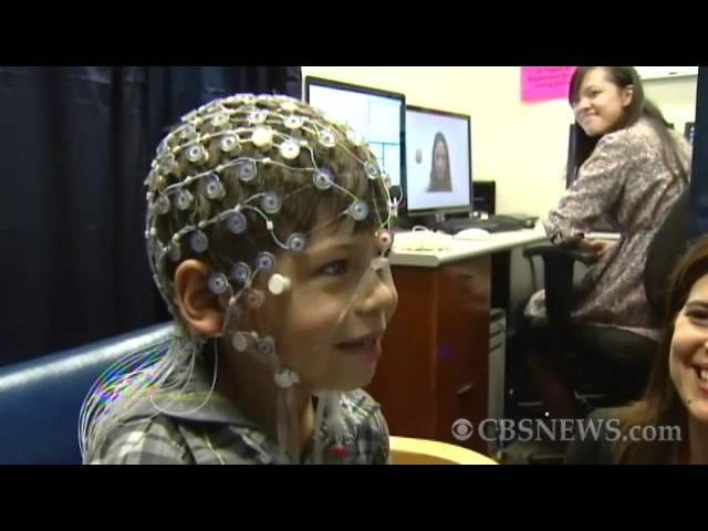 Break reported in autism treatment, detection