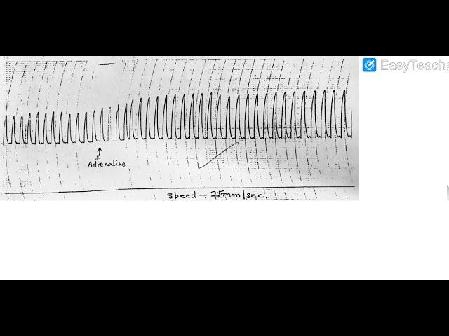 Effect of drugs on Frog’s Cardiogram