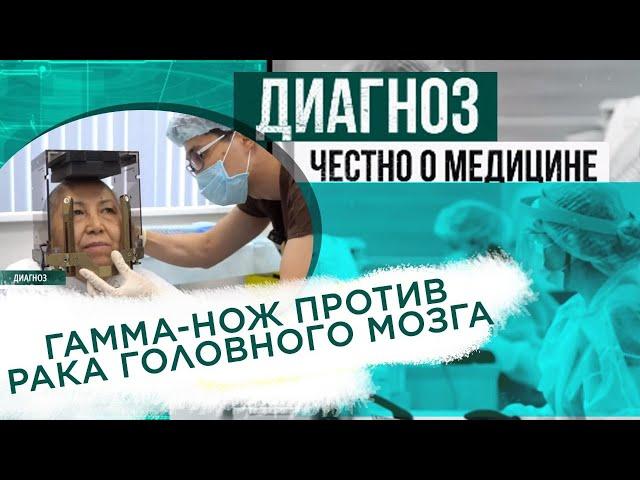 Лечение рака головного мозга гамма-ножом | Диагноз