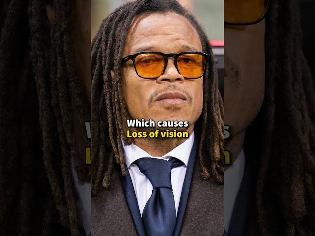 Why was Edgar Davids Wearing Glasses during Matches?