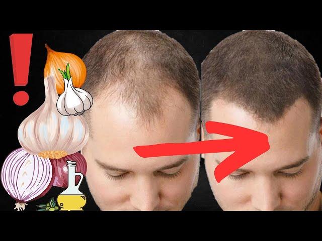 Hair grows like crazy and doesn't fall out! Only 2 homemade recipes