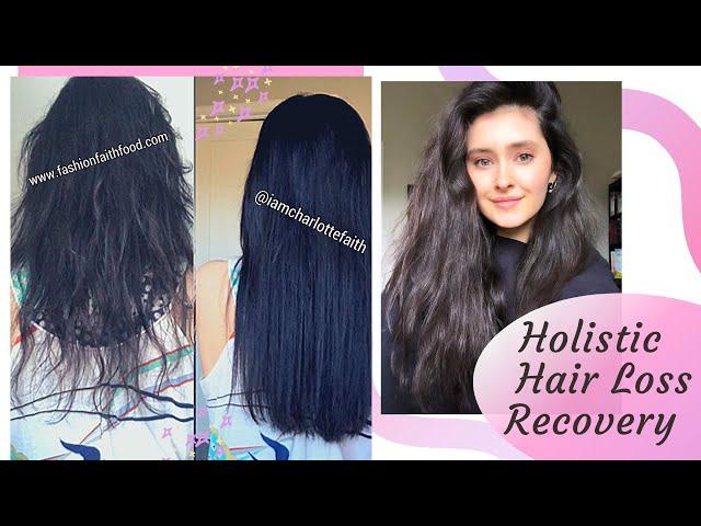 Recovered my Hair Loss  + Why I lost it + What I took