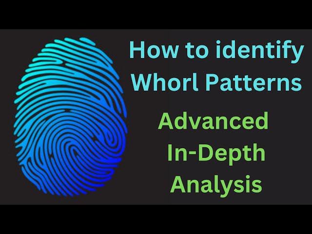 How to identify Whorl Patterns in DMIT Report Generation Software | Advanced In-Depth Analysis