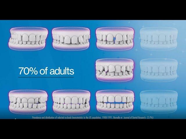 Get Your Oral Health Straight with Invisalign Treatment
