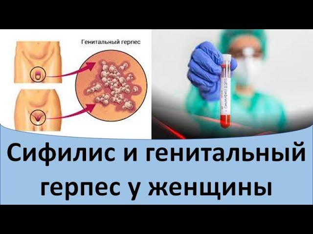 Сифилис и генитальный герпес у женщины