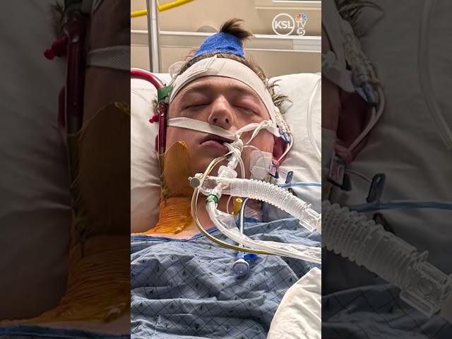 Utah teen recovering in coma after motorcycle crash