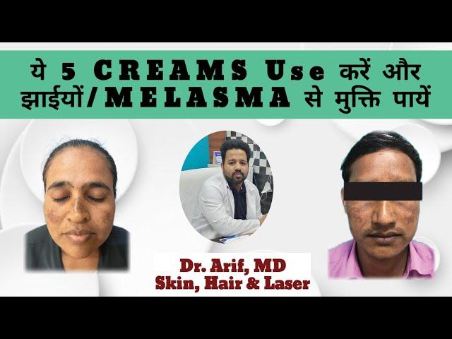 5 CREAMS FOR MELASMA TREATMENT @DrArifMDDermatologist  #melasmatreatment #melasma