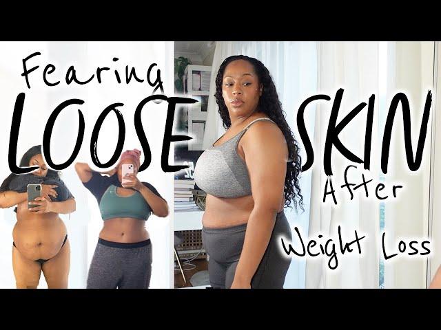 Loose Skin after Weight Loss? Is it even worth it to lose the weight?