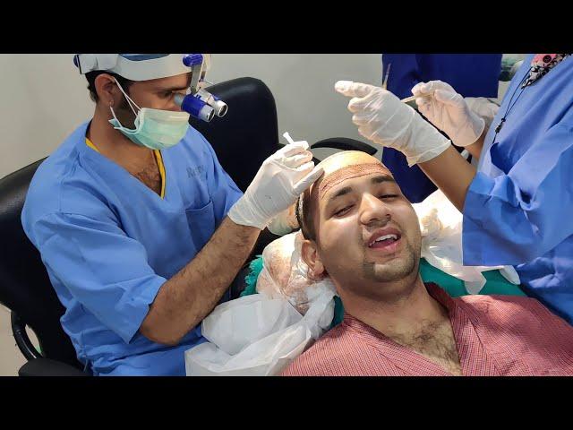 Patient's Opinion During The Surgery || Hair Transplant In India || Regrow Clinic Haridwar