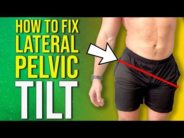 How to Fix Uneven Hips | Lateral Pelvic Tilt Correction Exercises