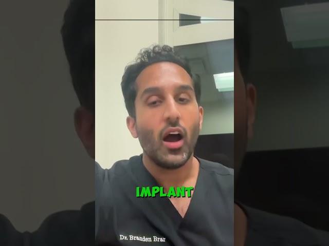 Do I need a dental implant? Dr. Brar breaks down when a dental implant is needed!