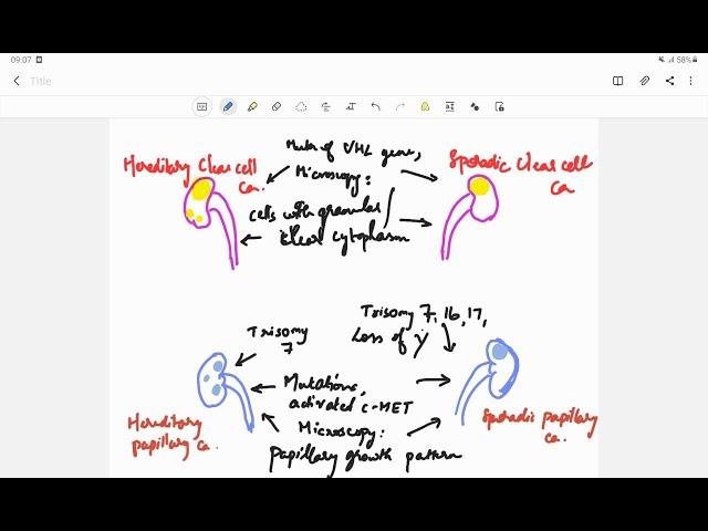 Renal cell carcinoma (RCC) | Pathology | Handwritten notes