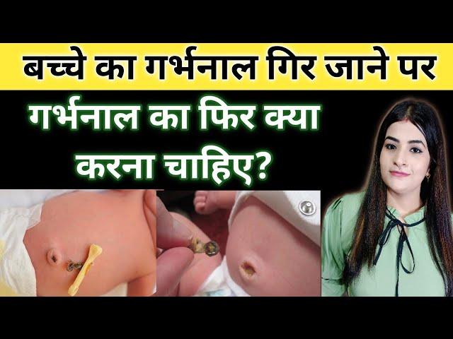 Bachche Ka Garbhnal Gir Jane Par Garbhnal Ka Kya Karna Chahiye | Umblical Cord | Reshu's Baby Care