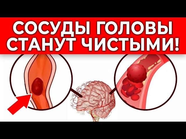 Пей ЭТО от головной боли! Сосуды головы станут ЧИСТЫМИ! | 3 способа очистить сосуды