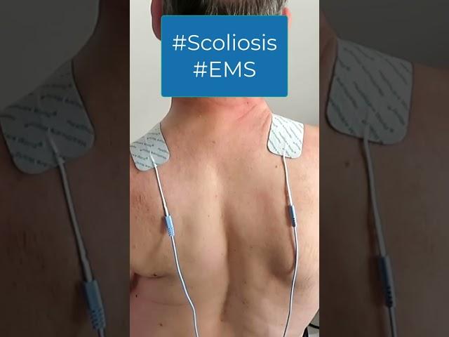 GoodBack Short EMS (Electro Muscular Simulation) #scoliosistherapy #scoliosistreatment #scoliosis