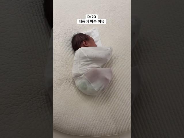 신생아 태동이 아픈이유ㅎㅎ #아기 #baby #신생아 #cutebaby #newborn #육아 #신생아태동