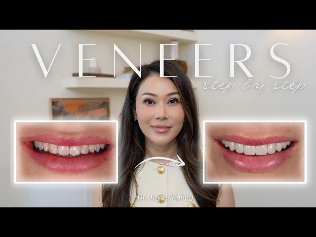 The Entire Veneers Process - Everything You Need to Know with Dr. Joyce Kahng