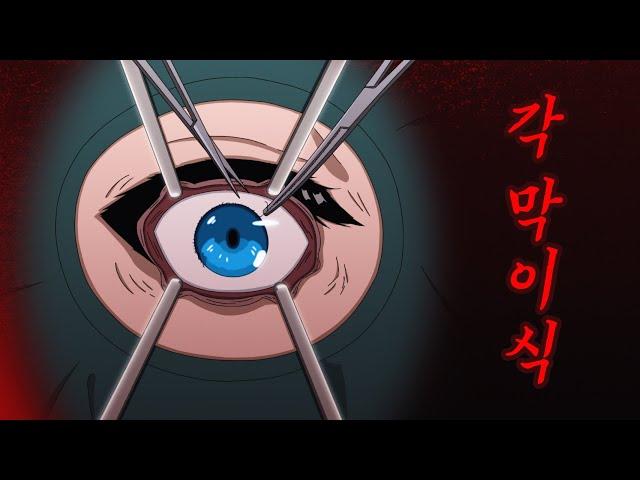 [무서운 이야기] 각막이식