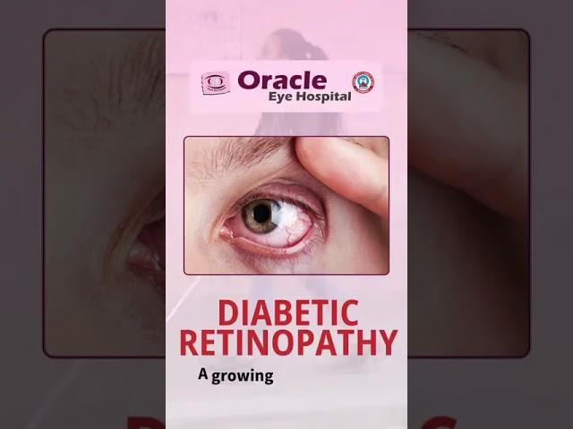 ️ Don’t Take Your Vision for Granted — Early Prevention Can Save Your Sight! ️