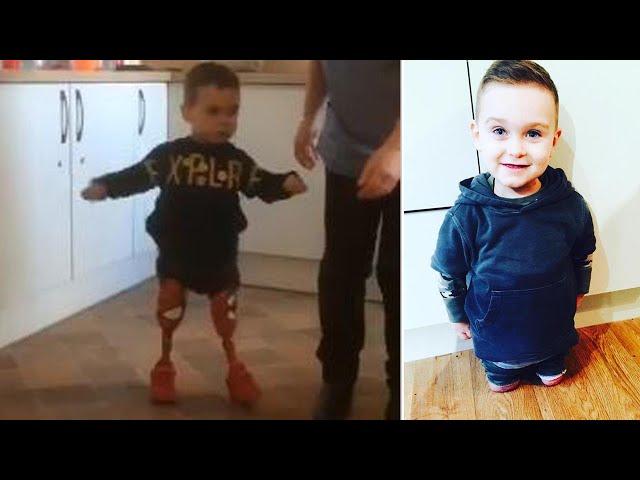 3-Year-Old Amputee Takes First Steps by Himself on Prosthetic Legs