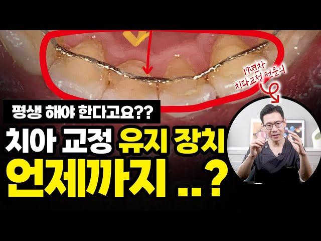 치아 교정 유지 장치 평생 한다고요?! | 교정 유지 장치 기간 딱! 정해드릴게요!