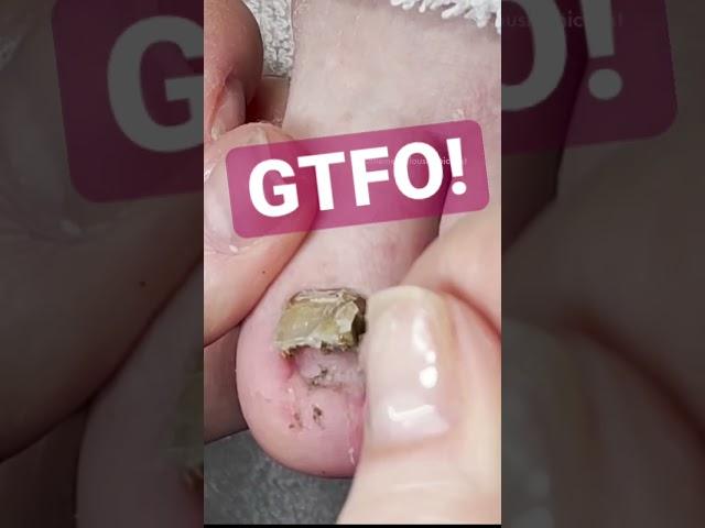 Get the funk out! Cleaning under lifted nail. #meticulousmanicurist #gtfo #cleaning #pedicure