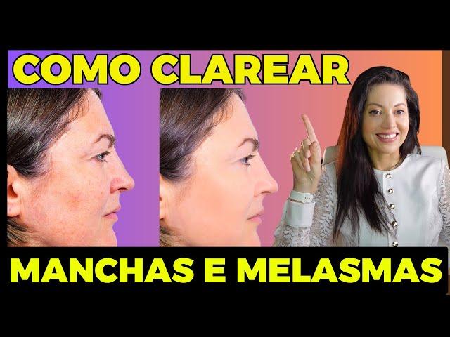 Guia Definitivo para Clarear Manchas e Melasmas em 2024 | Dra. Greice Moraes