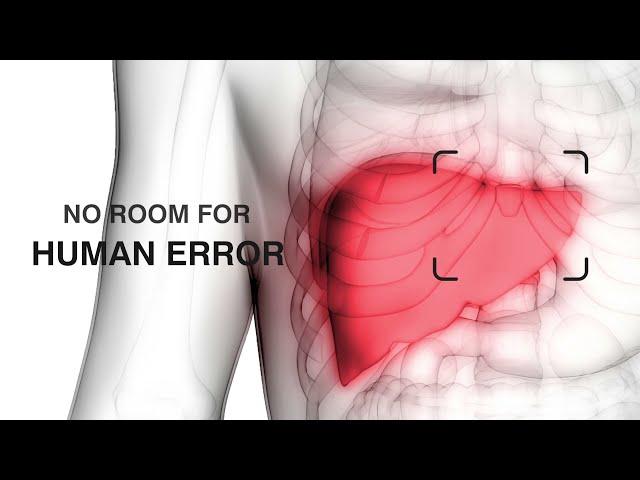 Robotics Liver Donor Surgery at Rela Hospital