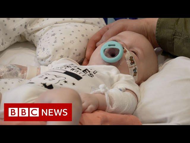 World's most expensive medicine treats infants with genetic disorder - BBC News