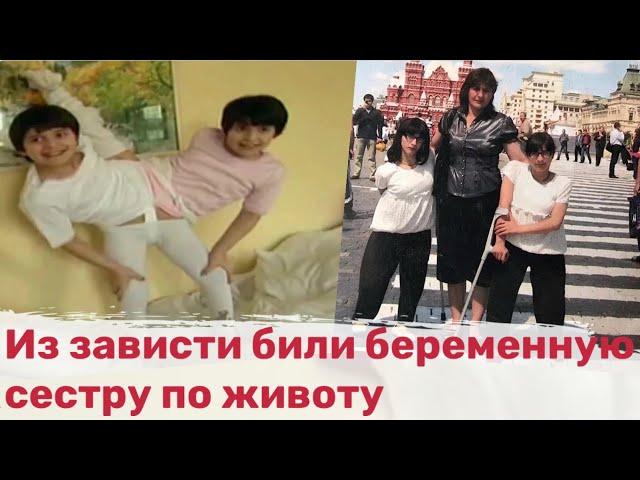 Гита без Зиты. Как складывается жизнь сиамской близняшки после смерти сестры