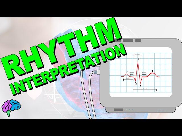 The Complete ECG Rhythm Interpretation Series!