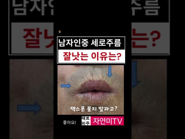 색소폰이 입술주름을 만든다고? #입술고양이주름 #신촌성형외과 #입술치마주름 ##인중세로주름 #은평성형외과 #홍대성형외과 #신촌성형외과 #입술보톡스 #입술주름영구교정 #입술필러