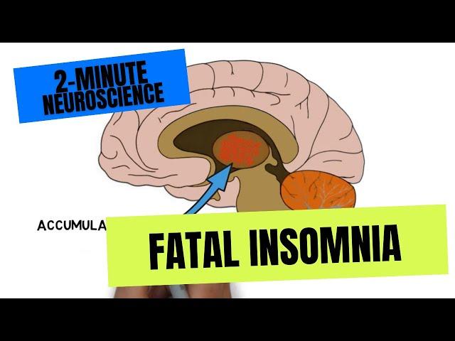 2-Minute Neuroscience: Fatal Insomnia